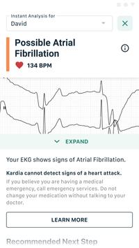 Kardia心电图检测免费版3